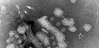 enterovirus 68